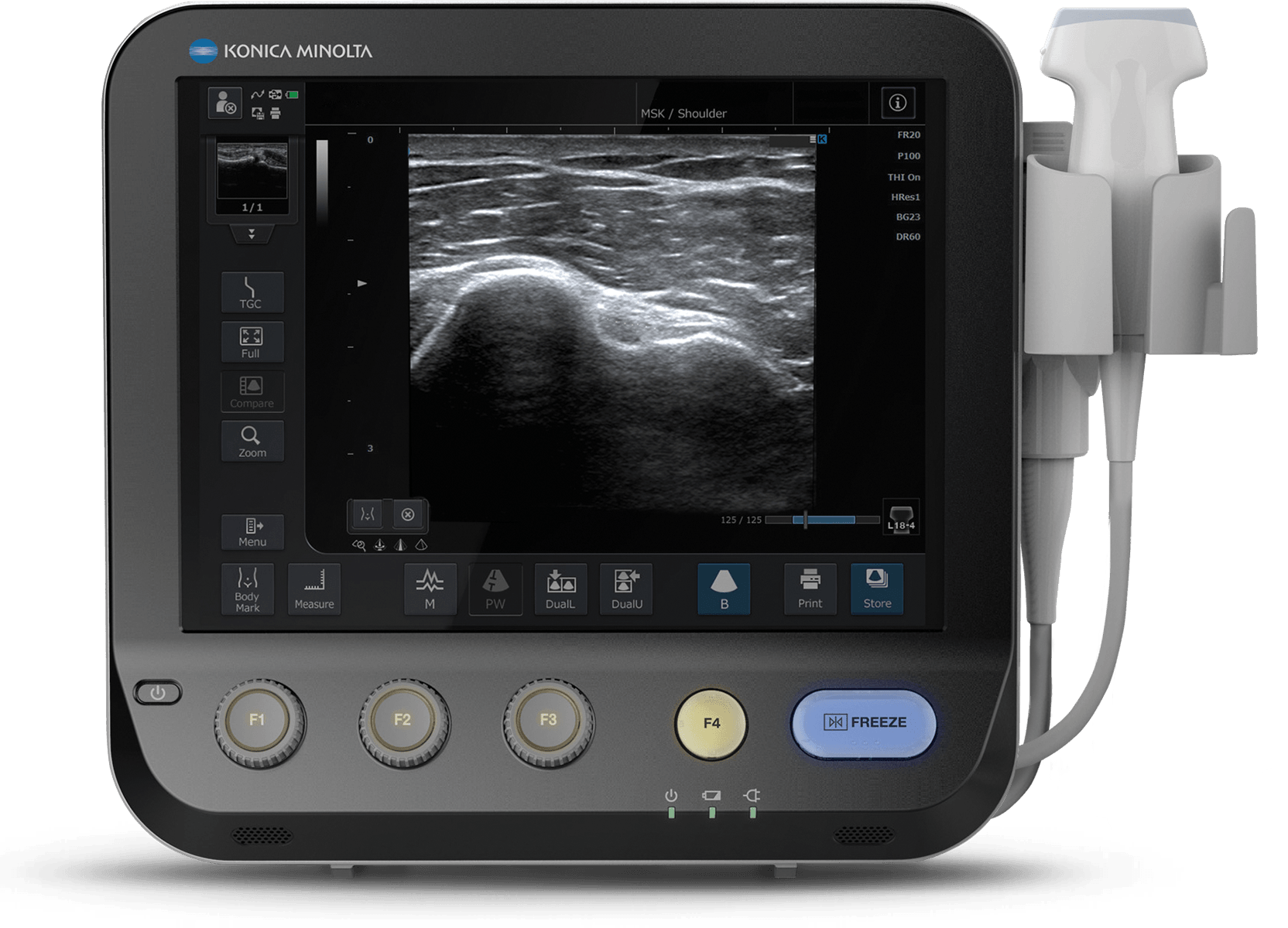 diagnostic-ultrasound